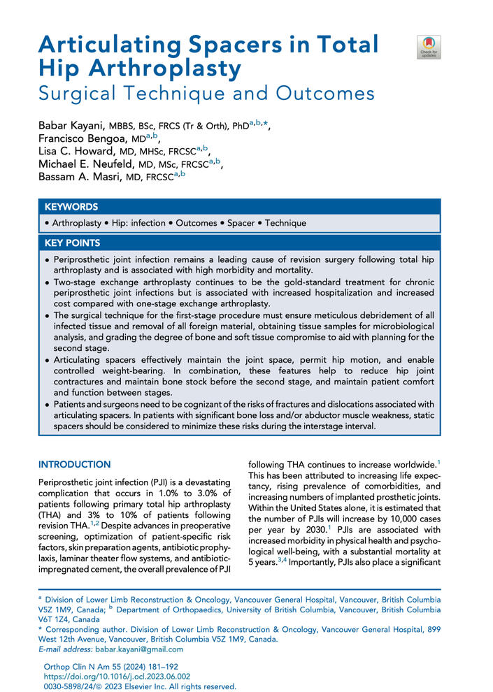 Articulating spacers review Articulating spacers review